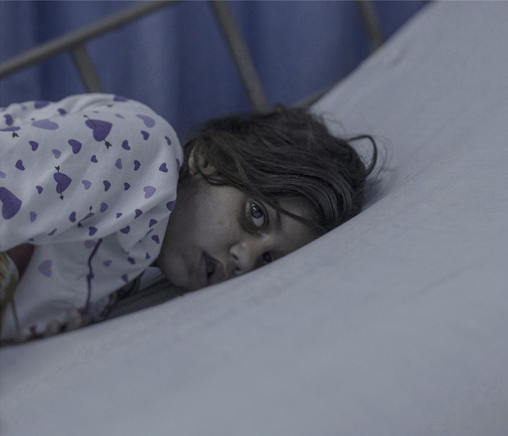 EXCLUSIVE, SPECIAL FEES APPLY. Must Credit - Magnus Wennman/Rex Mandatory Credit: Photo by Must Credit - Magnus Wen/REX Shutterstock (2853832m) Maram, 8, in Amman, Jordan Magnus Wennman: Where the children Sleep - 27 Sep 2015 Eight-year-old Maram had just come home from school when the rocket hit her house. A piece of the roof landed right on top of her. Her mother took her to a field hospital, and from there she was airlifted across the border to Jordan. Head trauma caused a brain hemorrhage. For the first 11 days, Maram was in a coma. She is now conscious, but has a broken jaw and can’t speak.